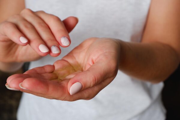 Alergia la acrilați: de ce apare brusc, după ani de manichiură cu gel
